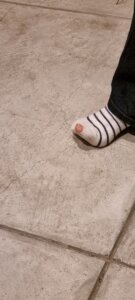 Un trou dans une chaussatte de Sphie